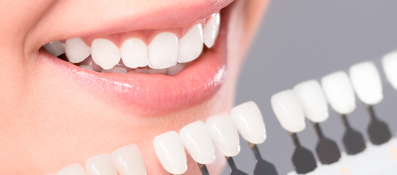 estetica dental