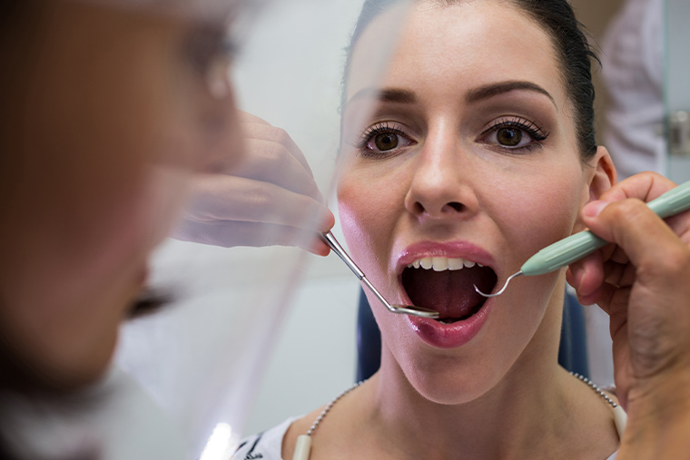 sarro-de-los-dientes