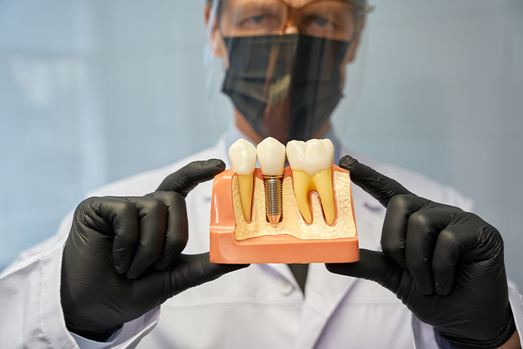 que-es-la-osteointegracion