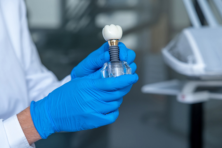 que-son-los-implantes-con-carga-inmediata