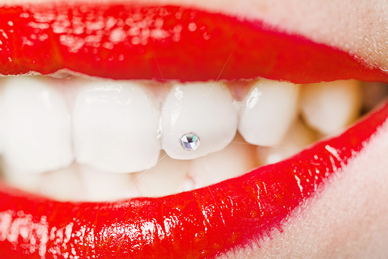como-cuidar-tu-piercing-dental