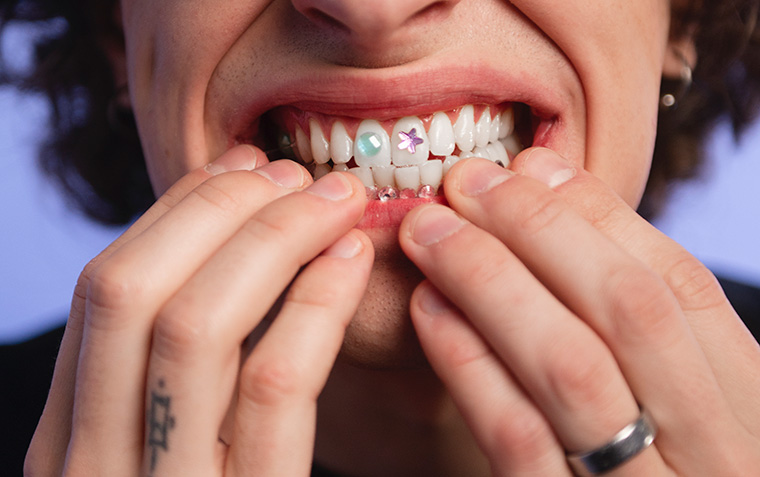 cuanto-cuesta-un-piercing-dental