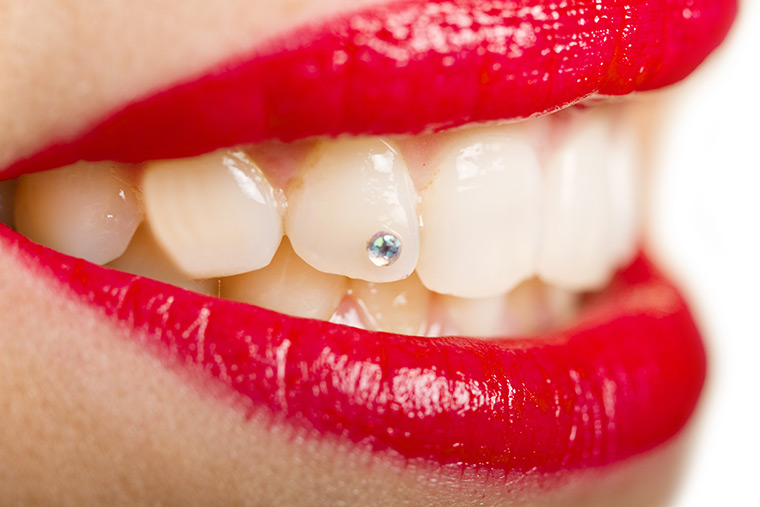 cuidar-piercing-dental