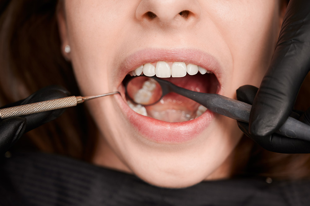 fotografia-macro-de-una-hermosa-sonrisa-femenina-con-dientes-blancos-y-sanos